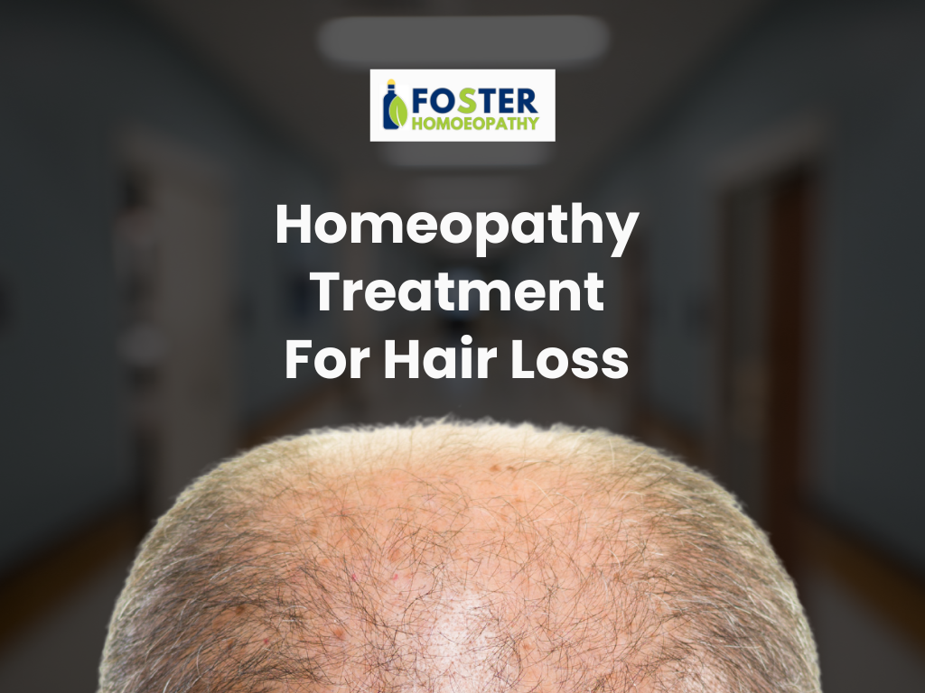 Homeopathy Treatment For Hair Loss in Men & Women