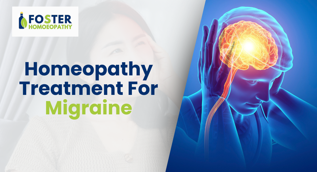 Homeopathy treatment for migraine - natural remedies and consultation