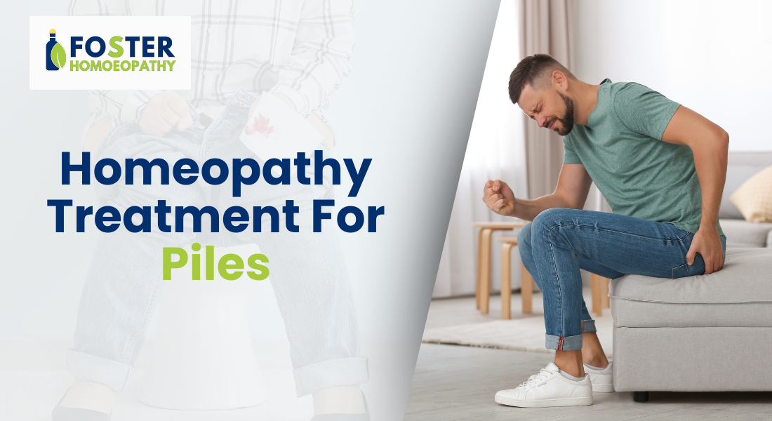 Homeopathy treatment for piles - natural remedies and relief