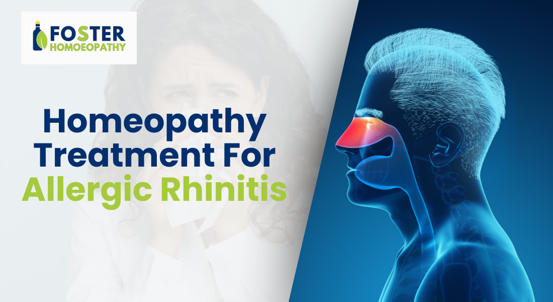 Homeopathy treatment for allergic rhinitis featuring natural remedies