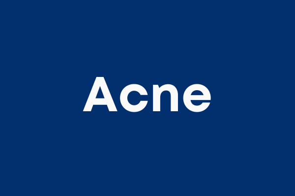 Acne Homeopathy Treatments in Hyderabad